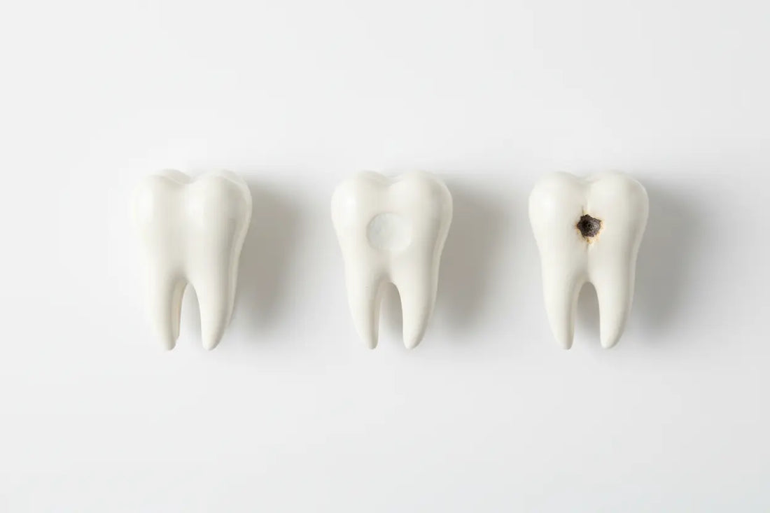 What Happens During Enamel Demineralization?