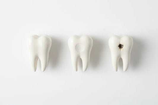 What Happens During Enamel Demineralization?