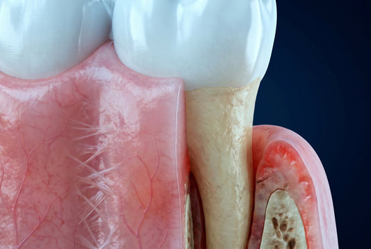Chewing Gum for Receding Gums: What Helps and What Doesn't